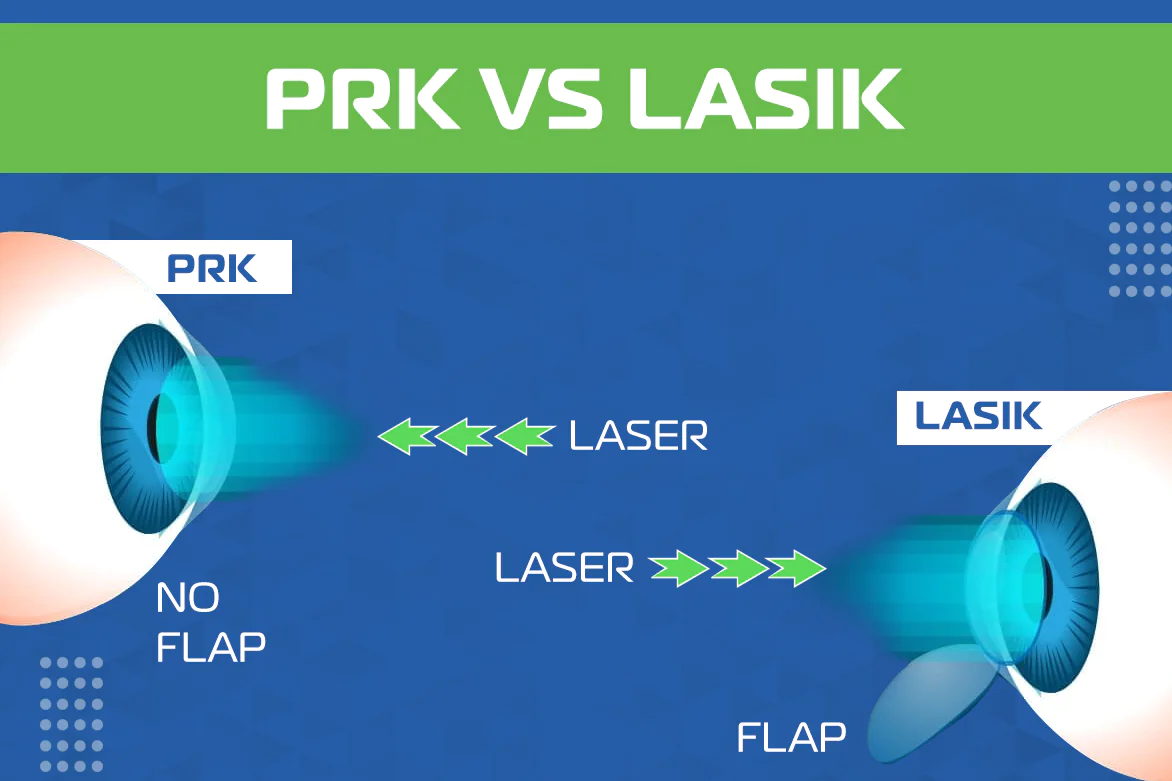 LASIK or PRK