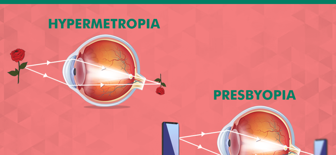 difference between presbyopia and hypermetropia